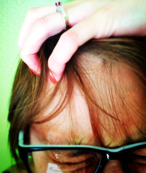 Got itchy skin?