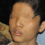 3rd generation- born with no eyes or no eye sockets 3rd generation- born with no eyes or no eye sockets