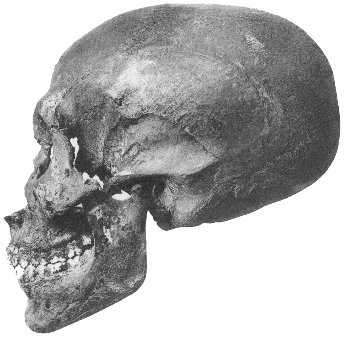 Skull of Akhenaten