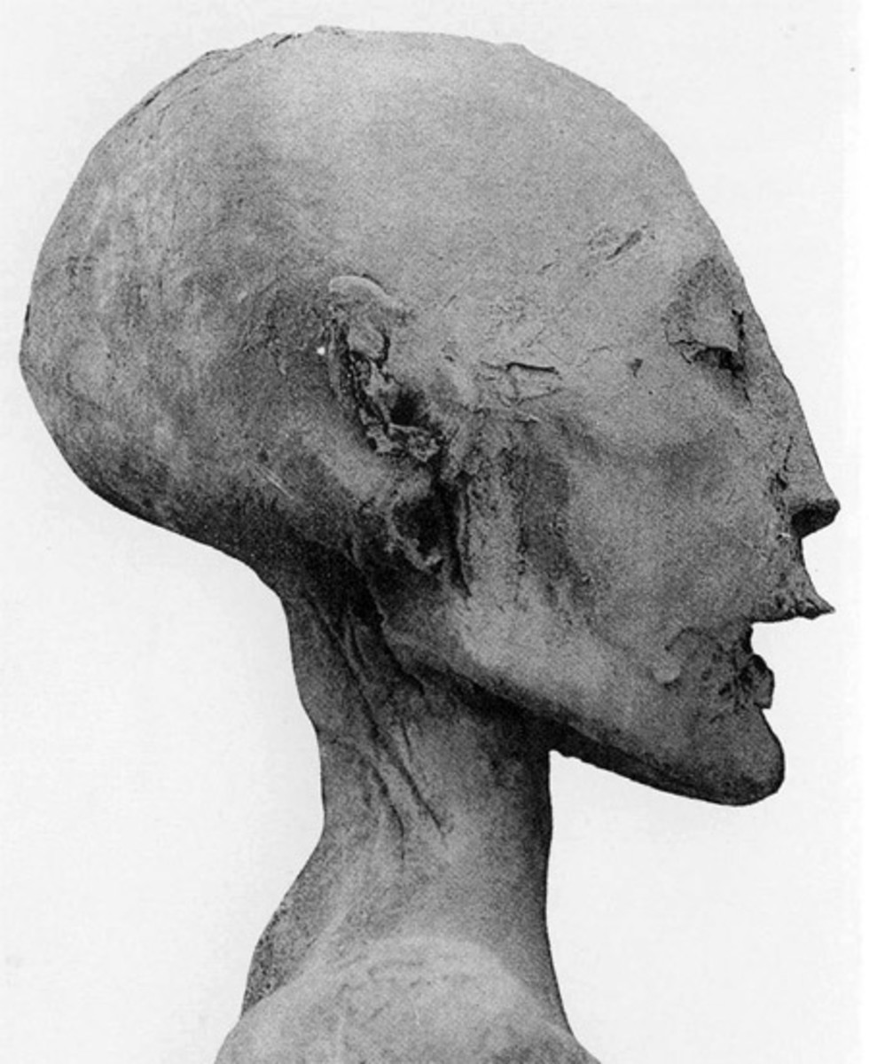 Younger Lady of KV35 Sister of Akhenaten and mother of Tutankhamun
