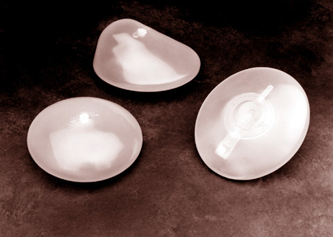 Silicone-filled gel implants
