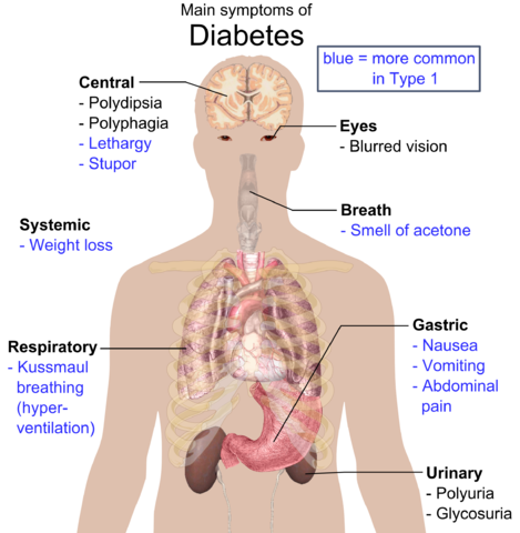 Diabetes Overview