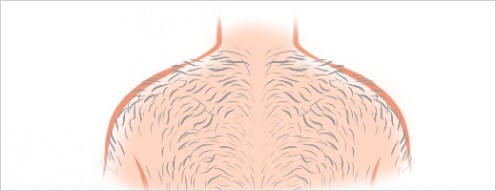 How to Shave Your Back for Men (Illustrated) How to Shave Your Back for Men (Illustrated)