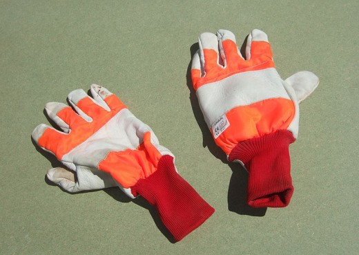 Hand injuries are extremely common when dealing with scrap metal. Be safe!