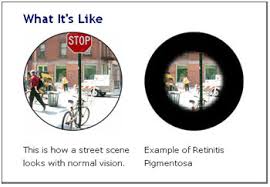 From the outside, they look the same, but what they see may be different.