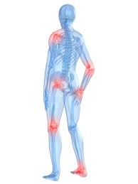 Arthritis Can Affect Many Joints in the Body