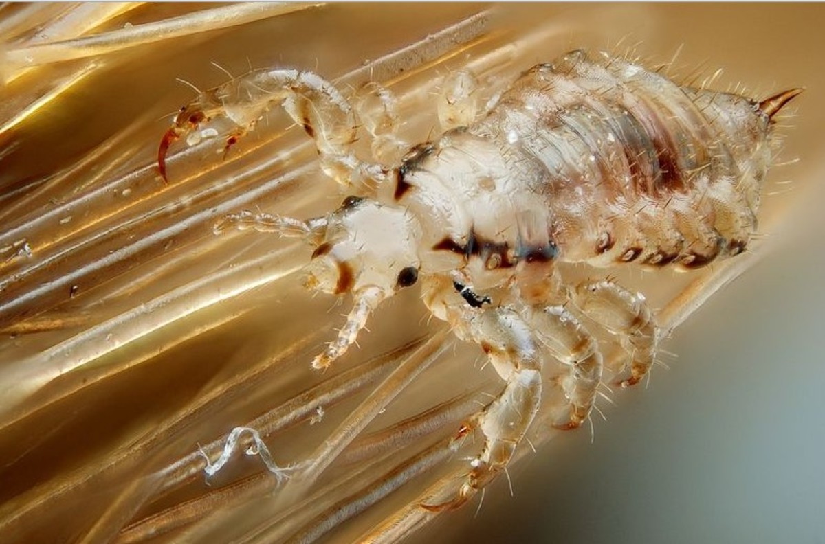 5 Signs of Lice and How to Get Ride of Them Once and For All