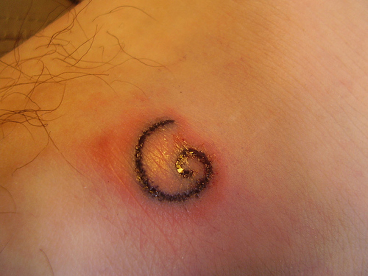 Symptoms Of An Infected Tattoo | HubPages