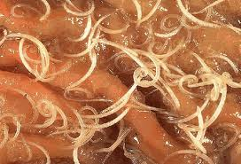 Intestinal worms