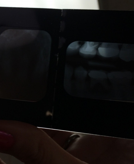 More of Gina's Teeth