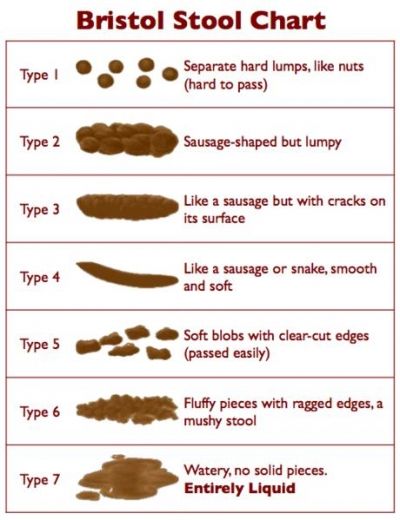 The Bristol Stool Chart is a medical aid designed to classify the form of human poop into seven categories