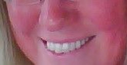 Finally! A Real Answer For Why Is My Face Always Red And Flushed - 19sg21s